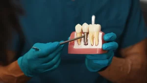 Çayırova İmplant Tedavisi