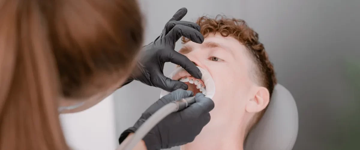 Çayırova Diş Çekim Hizmetleri