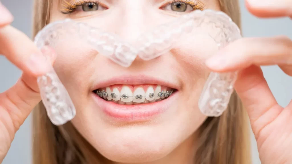 Çayırova Diş Teli Tedavisi