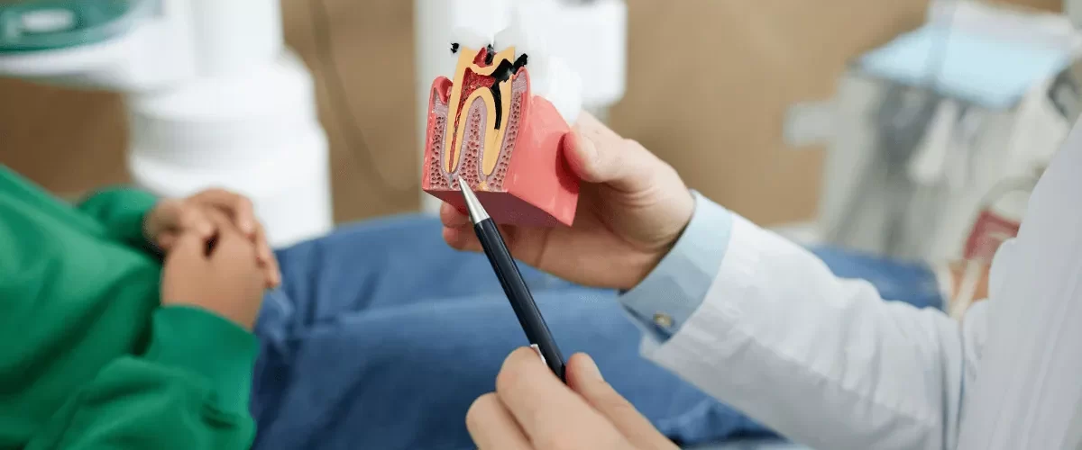 Çayırova Kanal Tedavisi